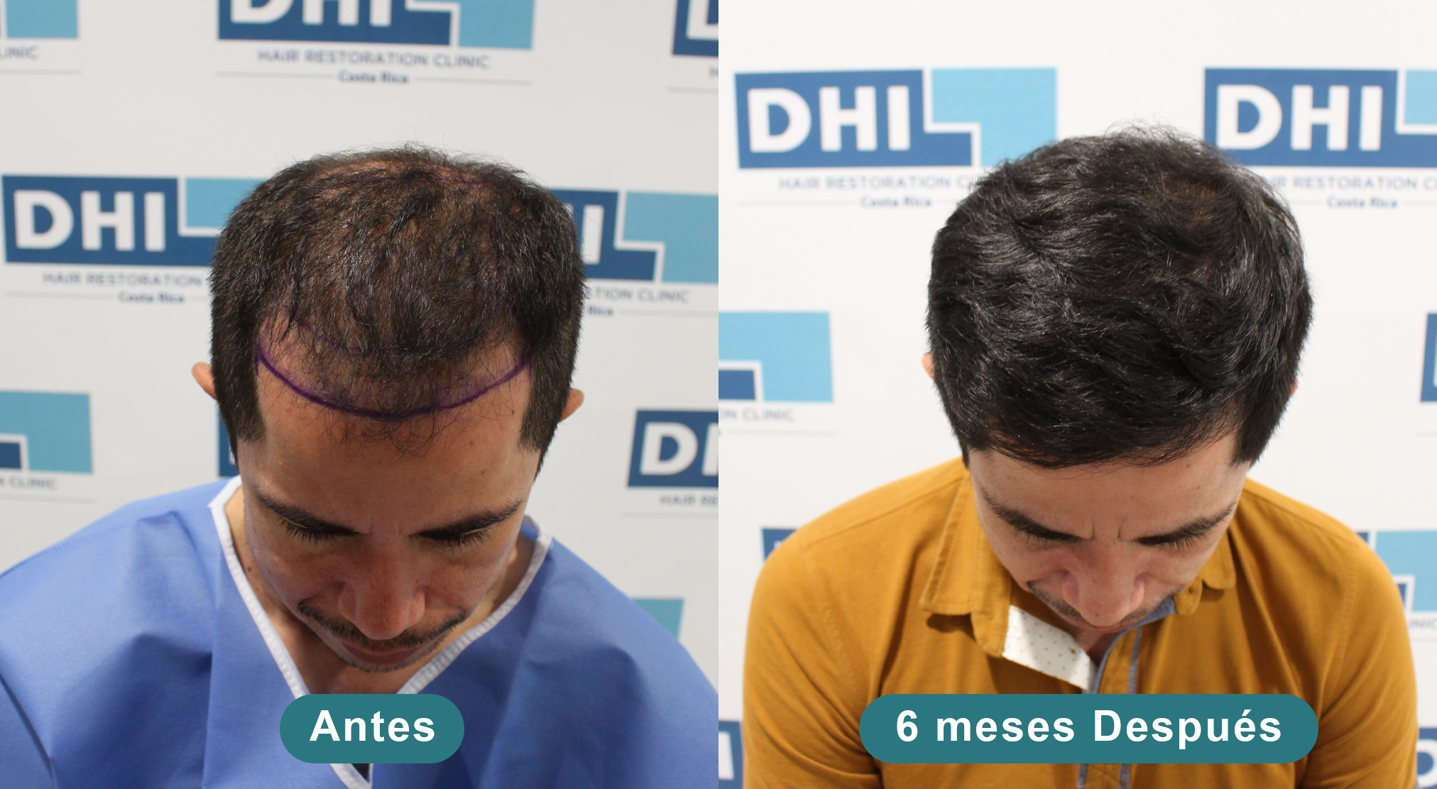 Antes y Después Antes y Después